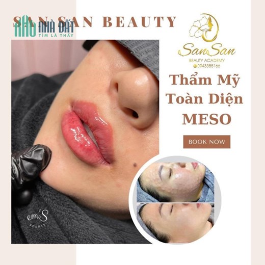 SAN SAN BEAUTY CHƯƠNG TRÌNH SIÊU ƯU ĐÃI DỊCH VỤ FILLER CHỈ CÒN 999K/1cc C.ấ.y Collagen HA chỉ #999k